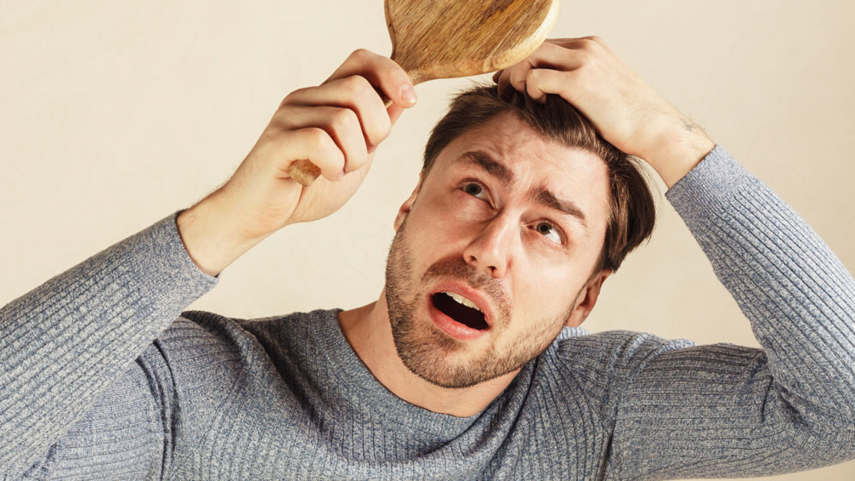 Early-signs-of-male-pattern-baldness